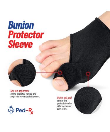 Ped-Rx Bunion Corrector Set - Orthopedic Splint for Overlapping Toes, Hammer Toe - 8 Piece Kit for Women and Men - Includes Bunion Sleeves, Toe Separators, Spacers, and Gel Shields (Black) - Buy Online on GoSupps.com