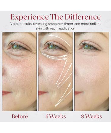 2.5% Resurfacing Retinol Cream - High Potency Anti-Aging Moisturizer with Hyaluronic Acid Vitamin B5 & E Green Tea - Firming & Lifting for Face and Neck (50ml - Buy Online on GoSupps.com