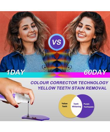 Purple Teeth Whitening Toothpaste | Brighten Teeth & Remove Stains | Color Correction Serum for White Smile - Buy Online on GoSupps.com