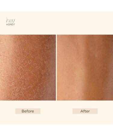 Hey Honey Skin Care Mango & Honey Water-Free Body Lotion - Hyaluronic Acid Ceramides & Barrier Repair for Hands Elbows & Dry Sensitive Skin | 24-Hr Hydration Fruit Enzymes Cruelty-Free | 6.7 oz - Buy Online on GoSupps.com