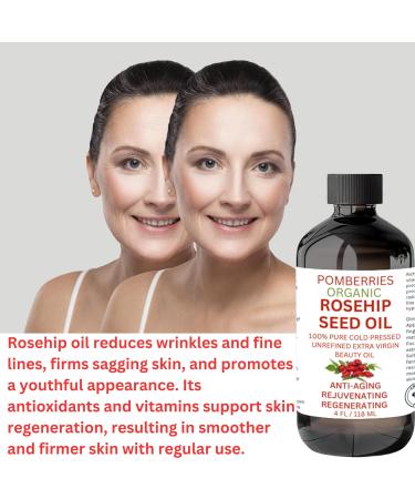 Premium Organic Rosehip Oil | Cold-Pressed Anti-Aging Face Oil | Reduces Wrinkles & Rich in Vitamin C | Natural Skin Care Moisturizer - Buy Online on GoSupps.com