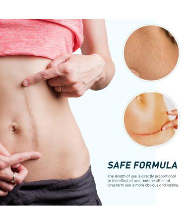 Mebak Silicone Scar Gel - Scar Therapy for Old and New Scars - 30g - Buy Online on GoSupps.com