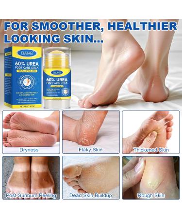 ITSDAWN Urea Cream 60 percent for feet 2 pieces - Buy Online on GoSupps.com