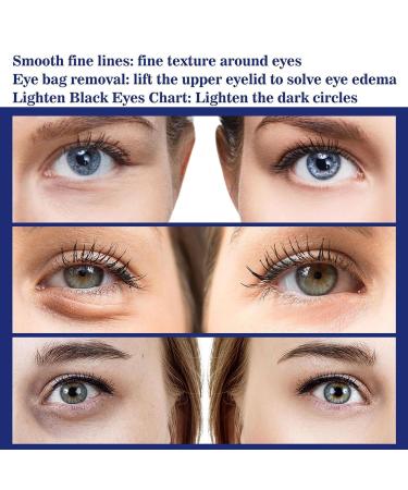 Sagrill Anti Wrinkle Essence & Serum Set | Glozie Eye Serum | Lifting Face Skin Care (3PCs) - Shop Internationally for Youthful Skin - Buy Online on GoSupps.com