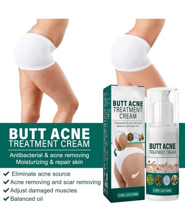Cr me nettoyante contre l'acn pour les fesses et les cuisses 100 ml de cr me d'acn pour les fesses cr me nettoyante anti-acn cr me anti-boutons sur les fesses limine les boutons et les taches - Buy Online on GoSupps.com