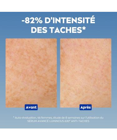 NIVEA Luminous 630 Coffret Soin de jour & S rum (1x1 pce) Soins visage anti taches pigmentaires au Thiamidol & Acide Hyaluronique Coffret cadeau femme soin anti- ge cr me hydratante visage - Buy Online on GoSupps.com