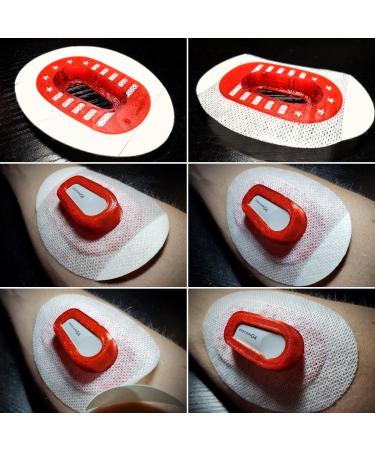 Hypoallergenic Dexcom G6 CGM Guard Patches - 10 Count, Waterproof, No Touch, Bumper Cover Tapes - White - Buy Online on GoSupps.com