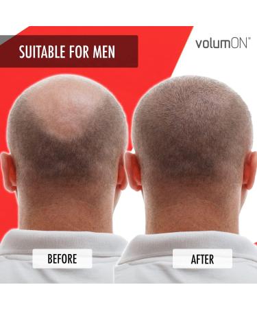 VOLUMON Keratin Hair Building Fibers for Thinning Hair - Instantly Conceals Thinning Areas for Thicker Hair - For Men & Women 28g + Optimizer & Applicator - Buy Online on GoSupps.com