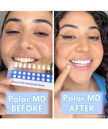 Polar MD Teeth Whitening Kit - Professional Gel Pens 1 Year Supply 32 LED Wireless Light - Compare to Whitening Strips - Buy Online on GoSupps.com