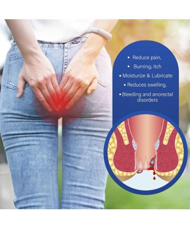 Villini Herbaluxy Hemorrhoid Treatment Ointment - External & Internal Hemorrhoid Shrinking Cream for Men and Women - Anus Fissure Relief - Buy Online on GoSupps.com