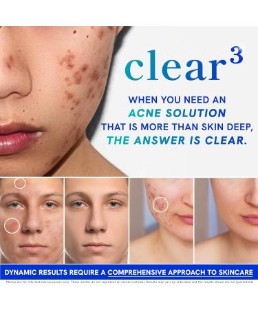 SMNutrition Clear Skin Acne Supplement Skin Support Vitamins for Women & Men - 120 Capsules - Buy Online on GoSupps.com