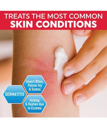 Medpride Hydrocortisone 1% Anti Itch Cream - Maximum Strength Relief for Mosquito Bites, Eczema & More - 16 oz - Buy Online on GoSupps.com