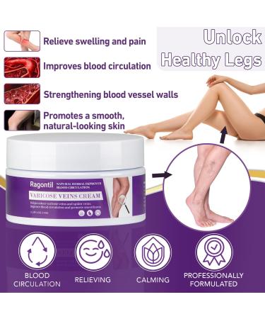 Varicose Vein Cream 3.53 Oz | Soothing Cream for Varicose & Spider Veins | Effective Relief for Legs - Buy Online on GoSupps.com