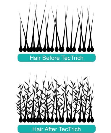 Hair Building Fibres for Thinning Hair (Auburn) - Buy Online on GoSupps.com