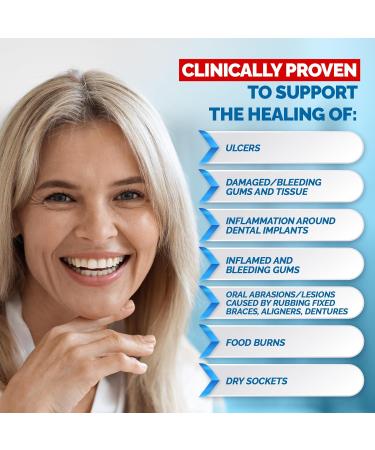 Gengigel Hyaluronic Acid Oral Gel for Mouth & Gum Discomfort (20ml) Soothes Irritation Promotes Natural Healing & Protects Delicate Oral Tissue No Paraben or SLS Vegan & Kosher 0.68 Fl Oz (Pack of 1) Adult - Buy Online on GoSupps.com