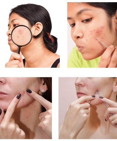 SAVBIN 7-Piece Blackhead Extraction Kit for Nose & Face - Professional Comedone & Pimple Remover Tool Set - Buy Online on GoSupps.com