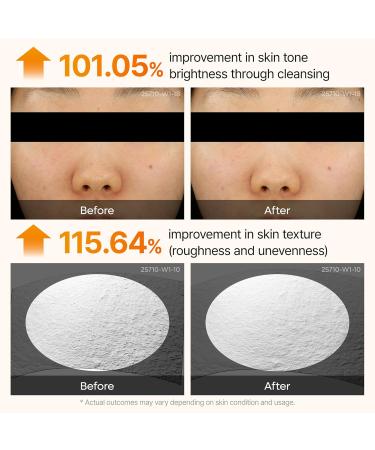 Dr.Melaxin Peel Shot Kojic Acid Turmeric Serum 80ml For Dark Spot Care Exfoliaing Dead Skin Korean Skin Care All Skin - Buy Online on GoSupps.com