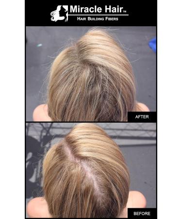 Premium All Hair Building Fibers - Medium Brown (10g) | Thicker Hair 75-Day Supply - International Shipping - Buy Online on GoSupps.com