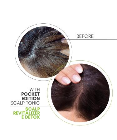 Pocket Edition Scalp Tonic 1.5 fl oz - Nourishing Green Formula for Healthy Hair | International Shipping Available - Buy Online on GoSupps.com