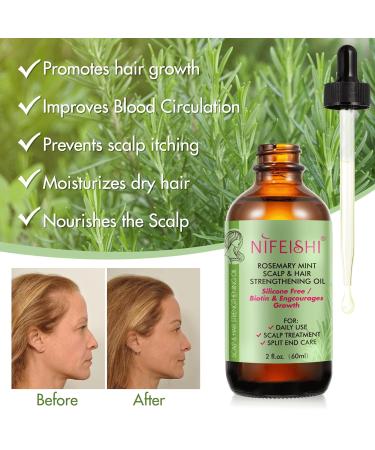 Rosemary Oil for Hair Growth - Strengthening Oil & Silicone Scalp Massage Brush | 60 ml - Buy Online on GoSupps.com