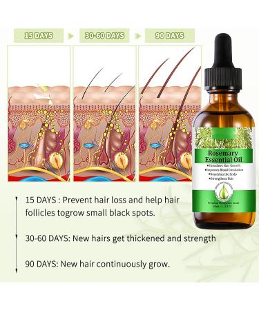 Rosemary Oil for Hair Growth Natural Organic Rosemary Essential Oil and Derma Roller Diluted for Eyelash Beard Eyebrows Face Skin Care Hair Loss Treatment Nourishes The Scalp Improve Blood Circulation - Buy Online on GoSupps.com