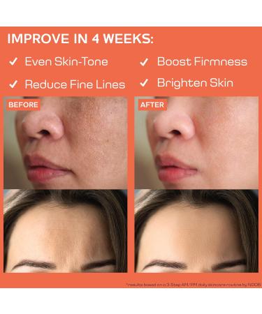 NOOB Organic All-Day Face Cream | Anti-Aging Moisturizer for Acne Prone & Sensitive Skin | Vegan with Hemp Oil Bakuchiol & Astaxanthin - 2 Oz - Buy Online on GoSupps.com