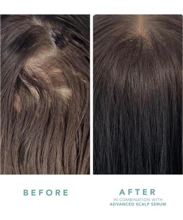 WE ARE PARADOXX Growth Scalp Serum with Trioplexx Technology - Stimulates Hair Follicles for Thicker, Healthier Hair - Natural Vegan Formula with Caffeine, Keratin, Biotin - 50ml - Buy Online on GoSupps.com