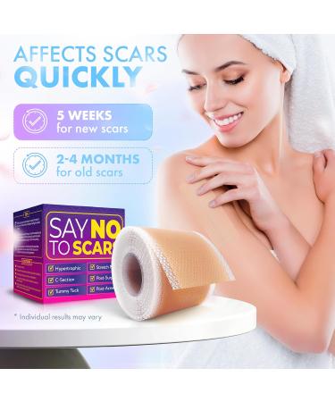 Silicone Scar Tape for Effective Scar Removal | Medical Grade 130x1.5 Inch Roll for Surgical Acne & Keloid Scars - Buy Online on GoSupps.com