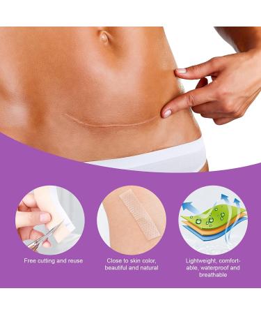 Silicone Scar Removal Sheets (Pack of 4) - 5.9 x 1.6 - Body, Surgical, Burn, Acne & Keloid Treatment - 2 Month Supply - Buy Online on GoSupps.com