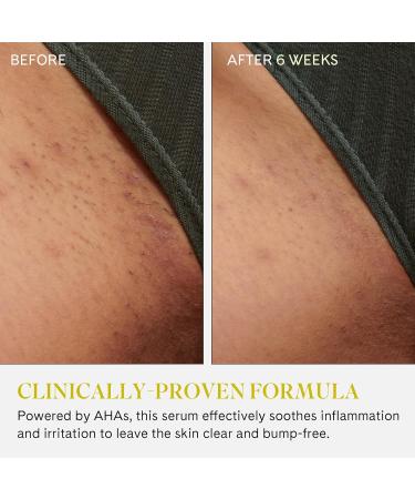 Fur Ingrown Eliminator Serum Rollerball - Powerful Ingrown Hair Treatment Serum With AHAs and BHAs to Treat and Prevent Ingrown Hairs and Bumps, Hydrates and Soothes Irritated Skin - 50 ml 1.7 Fl Oz (Pack of 1) - Buy Online on GoSupps.com