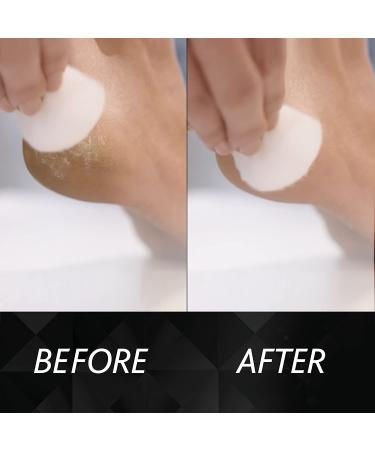 Amope Pedi Perfect Pro Wet & Dry Foot File - Rechargeable Callous Remover for Feet - Buy Online on GoSupps.com