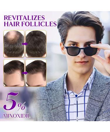Minoxidil 5% Hair Growth Spray with Biotin - Promote Healthy Hair Regrowth - 2.0 fl.oz - Buy Online on GoSupps.com