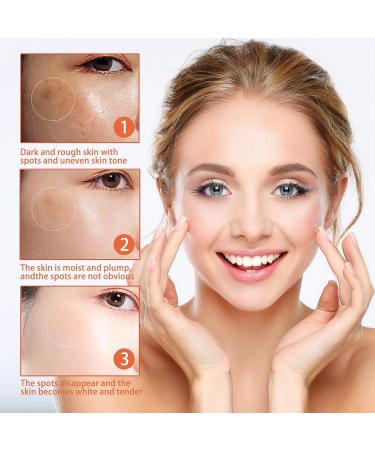 Melanin Correcting Cream Moisturizing Repair Cream Lefun Melanin Cream Dark Spot Corrector Cream Dark Spot Correcting Glow Serum Discoloration Correcting Serum Spot Cream for Women - Buy Online on GoSupps.com
