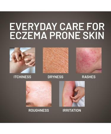 Emeu Charlevoix Eczema Relief Emu Oil Moisturizing and Healing Cream 100ml - Buy Online on GoSupps.com