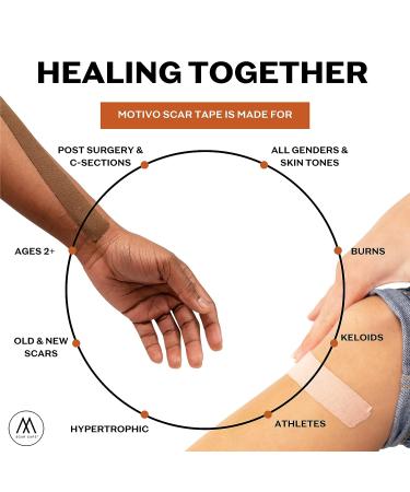 Motivo Scar Tape - 20 Strips | Water & Sweat Resistant, Latex-Free, Long-Lasting Adhesion | Ideal for Surgical Scars, C-Sections, Burns, Gender Affirming Surgery - Fair - Buy Online on GoSupps.com