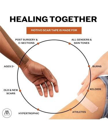 Motivo Advanced Scar Care Bundle: Scar Tape & Roller Serum (10ml) | Water & Sweat Resistant | Suitable for All Skin Types | Ideal for Surgical, C-Section, Trauma & Acne Scars | Fair - Buy Online on GoSupps.com
