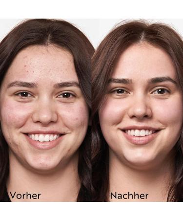  M. Asam M. Asam CLEAR SKIN Better Skin Fruit Enzyme Exfoliating (50ml) - AHA Peeling with Enzymes Gentle Fruit Acids Exfoliator for All Skin Types Exfoliating Skin Care for Clear Skin  - Buy Online on GoSupps.com