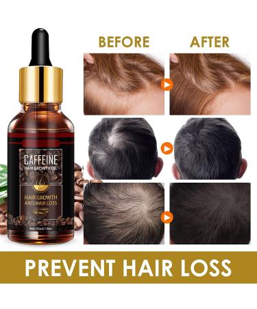 Hair Growth Serum with Caffeine, Biotin, and Castor Oil - 1.8 Fl Oz | Strengthen, Thicken, and Repair Dry Damaged Hair - Buy Online on GoSupps.com