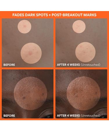 innisfree Green Tea Enzyme Vitamin C Brightening Cream Korean Face Moisturizer for Dark Spots Hydration & Radiant Skin 1.69 fl .oz. / 50ml - Buy Online on GoSupps.com