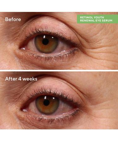 MURAD Rapid Wrinkle Repair Kit - Worth 168 Save 40 percent - 2 Full Sizes to Smooth Wrinkles in an Instant and Over Time - Eye Serum - Wrinkle Correcter - Buy Online on GoSupps.com