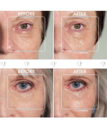 Crystal Clear Skincare 2 Percent Pharma Grade Hyaluronic Serum 30ml - Buy Online on GoSupps.com