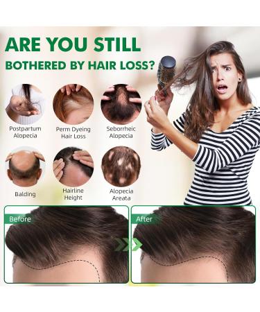 100% Natural Rosemary Oil for Hair Growth | 60ml Organic Rosemary Oil for Scalp Aromatherapy & Massage - Buy Online on GoSupps.com