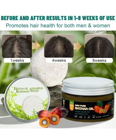 2Pack Batana Oil Shampoo Bars for Hair Growth | Nourishing & Moisturizing Solid Bars with Rosemary | Thinning Hair Deep Conditioning - 3.15 Ounce - Buy Online on GoSupps.com