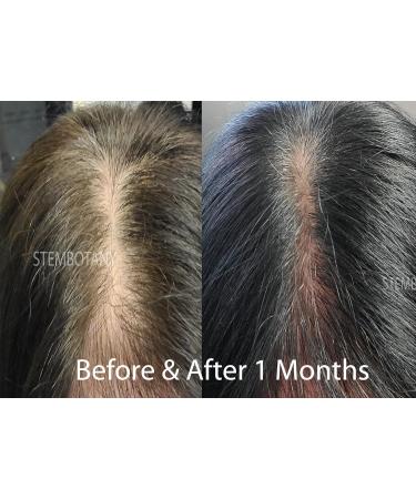 GHK-cu Copper Peptide Hair Regrowth Shampoo for Men & Women - Boost Hair Growth Nourish & Revitalize Shop Internationally - Buy Online on GoSupps.com