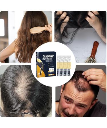 Formule de soin du cuir chevelu : cheveux de soutien adultes matures stylistes professionnels de salon et amateurs actifs soulage les d mangeaisons du cuir chevelu tout en favorisant une 10 pi ces - Buy Online on GoSupps.com