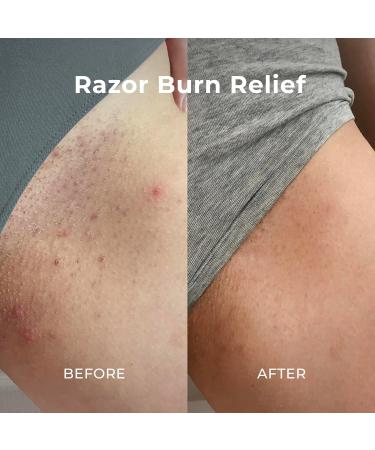 Miami Beach Bum Coco Body Scrub exfoliates breakouts and irritation Oregano & lactobacillus Glycerin & Coconut Oils Aloe 8oz - Buy Online on GoSupps.com