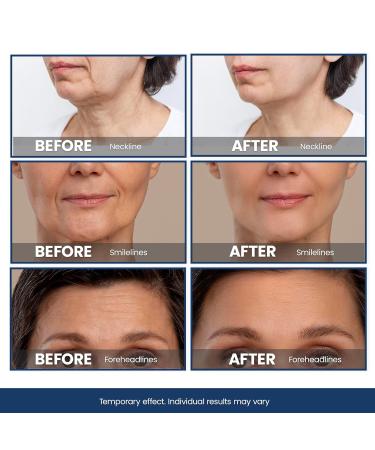 Bag Buster Eye Cream - Instant Reduction & Anti-Aging | Rapid Lift for Wrinkles Dark Circles & Fine Lines | Powdery Residue Free | 10ml - Buy Online on GoSupps.com