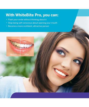 Whitebite Pro Teeth Whitening Kit - LED Light for Sensitive Teeth | 7-Piece System with 35% Carbamide Peroxide - Buy Online on GoSupps.com