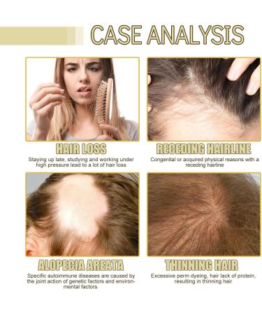 Veganic Natural Hair Growth Oil Natural Hair Growth Oil Veganic Hair Growth Oil Veganic Hair Oil Hair Oil for Dry Damaged Hair for Women and Men Promotes Growth and Thickness (2pc) - Buy Online on GoSupps.com