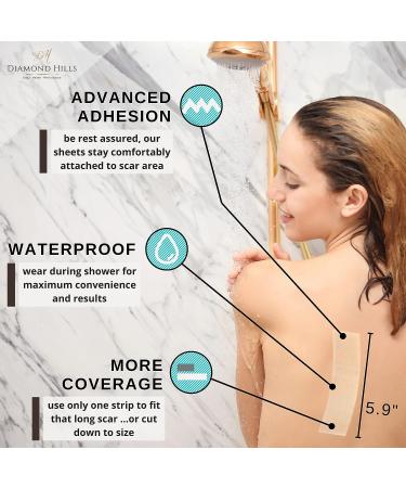 Diamond Hills Silicone Scar Removal Sheets - 4 Strips 5.9x1.57 - Fade, Flatten & Lighten Surgical Scars - Buy Online on GoSupps.com